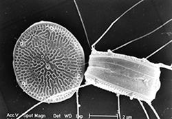 Thalassiosira sp.  Nanoplankton marino).